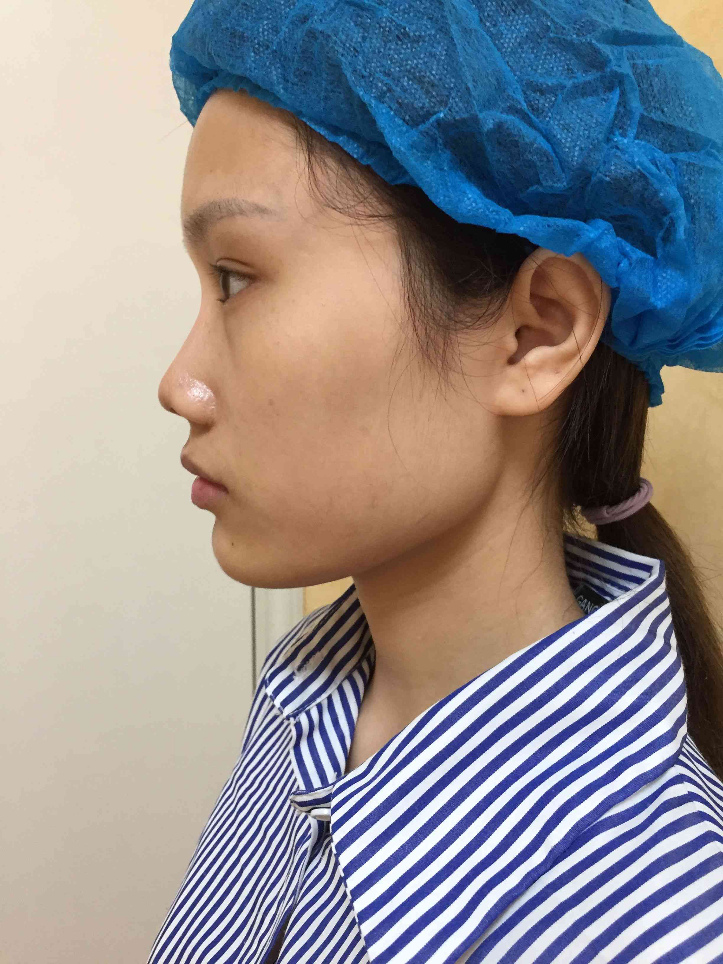 四川省成都軍建醫(yī)院怎么樣？2021價(jià)格表曝光+隆鼻真人案例分享