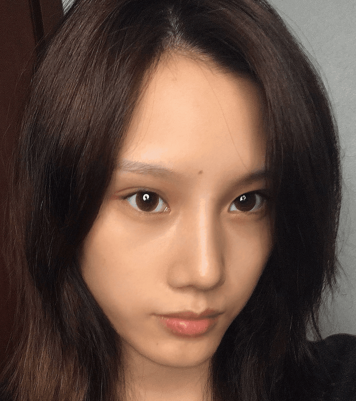 四川省成都軍建醫(yī)院怎么樣？2021價(jià)格表曝光+隆鼻真人案例分享