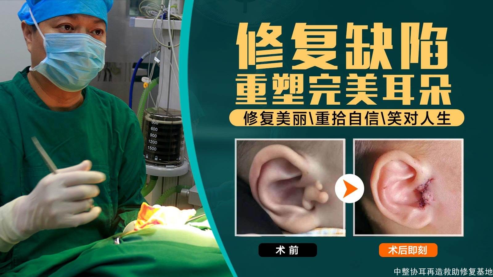 中國耳再造專家前10強(qiáng),前三安波/余文林/郭樹忠后悔知道晚了