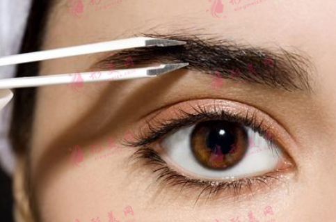 為什么激光洗眉后會(huì)有紅色痕跡?多久會(huì)消失?