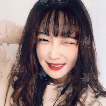 2022上海九院正畸(費(fèi)用)價(jià)格公示及案例分析