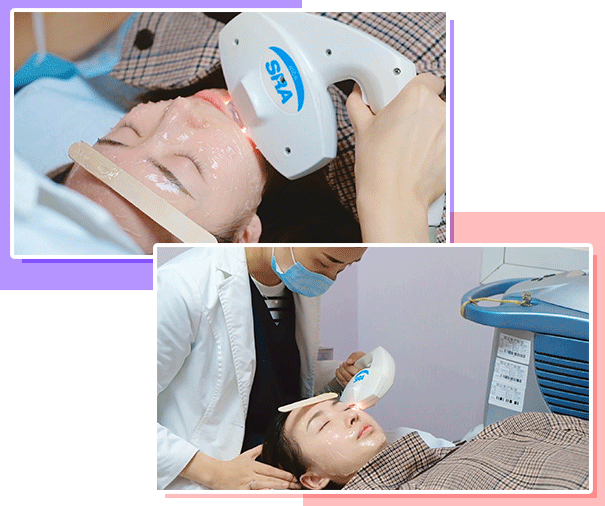 光子嫩膚和果酸換膚哪個好？原理+注意事項(xiàng)盤點(diǎn)！