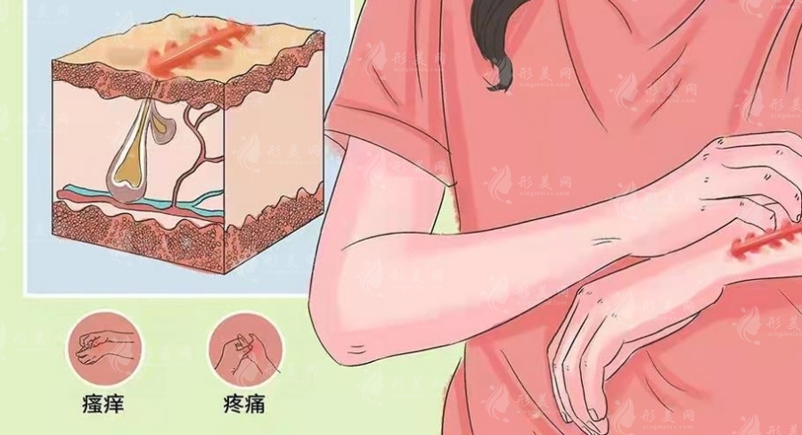 北京麗合醫(yī)療美容醫(yī)院疤痕科怎么樣？修復(fù)案例&專家信息&收費(fèi)標(biāo)準(zhǔn)