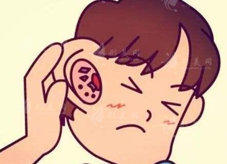 北京八大處耳再造費(fèi)用多少錢(qián)