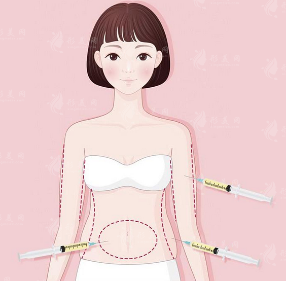 重慶銅雀臺醫(yī)療整形醫(yī)院好不好？正規(guī)三級整形醫(yī)院做吸脂口碑挺好的