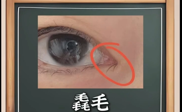 內(nèi)眼角的毳毛是什么，上海愛(ài)尚麗格的專業(yè)建議