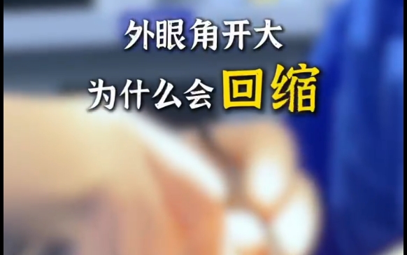 想知道為什么外眼角開大會回縮嗎？杜園園醫(yī)生來為您解答
