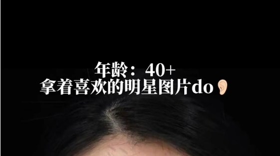 40+耳周抗衰前后對(duì)比，值不值呢？劉浩存同款