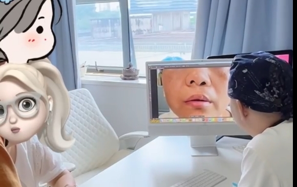 人中偏了！這種唇裂很難修復(fù)，余文林醫(yī)生案例分享