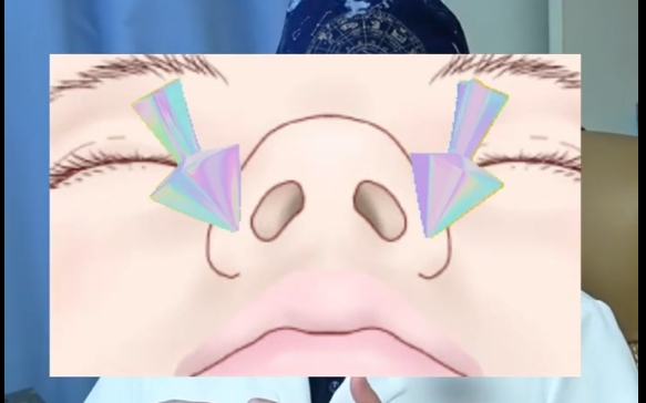 修復(fù)唇裂鼻畸形鼻尖的形狀都變了？余文林醫(yī)生解答