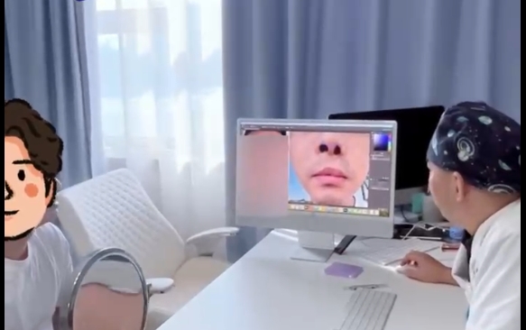 余文林醫(yī)生唇裂修復(fù)案例分享