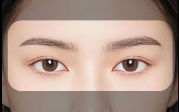 揭秘網(wǎng)傳的國泰民安眼：杜園園醫(yī)生帶你解析