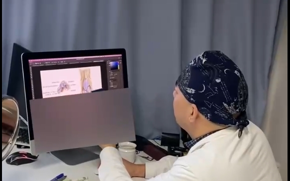 唇裂鼻修復(fù)后為何鼻子仍然歪斜？余文林醫(yī)生解答疑惑 