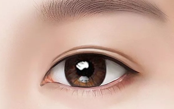 如何正確看待眼修復早期腫脹？杜園園醫(yī)生在線解析