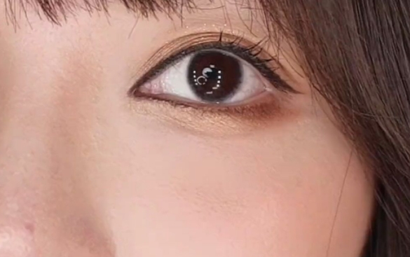 開(kāi)眼角開(kāi)大眼角過(guò)于尖銳怎么改善？杜園園醫(yī)生在線回答