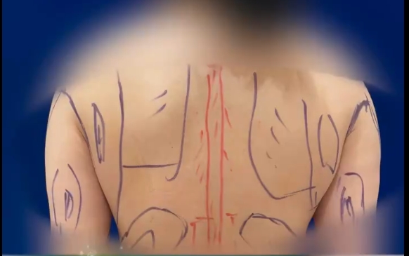 為什么體重并不重，卻顯得上半身很臃腫？