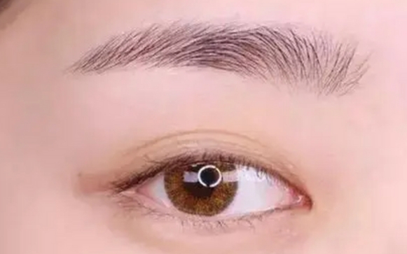 切開提眉失敗，眼睛會有哪些改變？