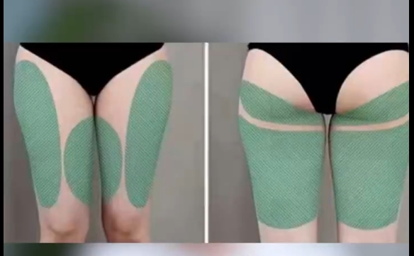 大腿千萬(wàn)別亂吸，小心裙子都沒(méi)法穿