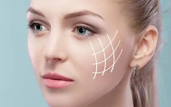 整形do臉的順序別弄錯！當(dāng)心失敗修復(fù)白花錢