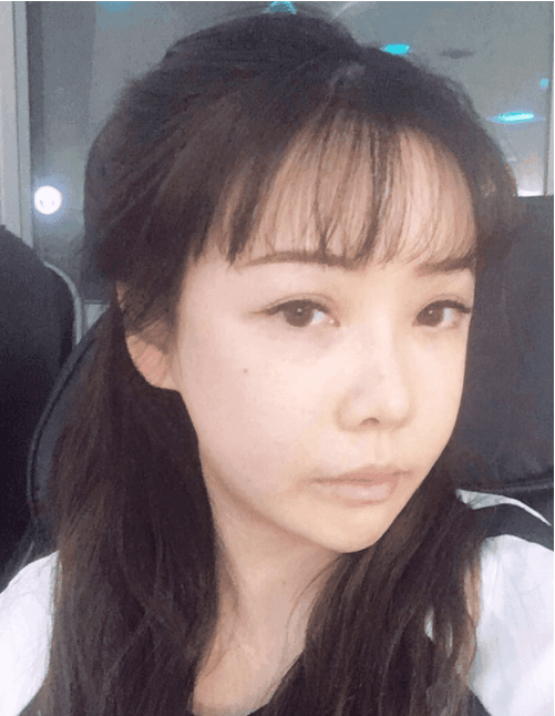 北京八大處磨骨多少錢(qián)？2022價(jià)格表曝光+磨骨案例