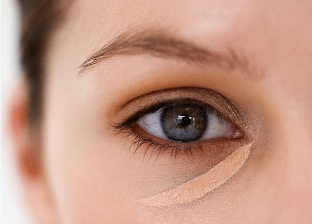 黑眼圈能不能做手術？多久能看見效果?