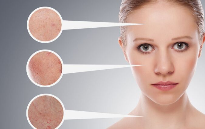 激光整形價(jià)格