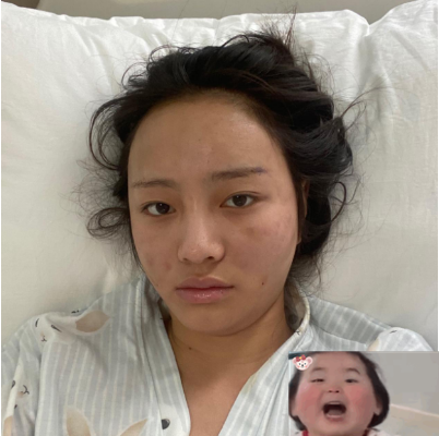 北京新星靚做面部脂肪填充效果好不好？