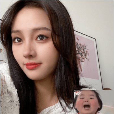 北京新星靚做面部脂肪填充效果好不好？