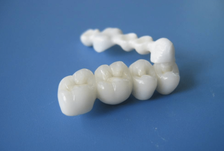 烤瓷牙怎么樣？好不好?