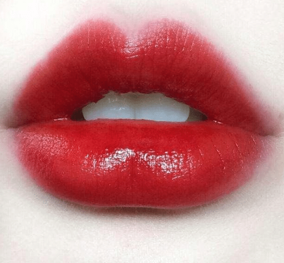 什么是自體脂肪豐唇？自體脂肪豐唇需要注意什么？