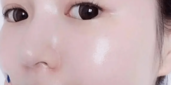 面部出油多是什么原因？有什么方法可以改善？