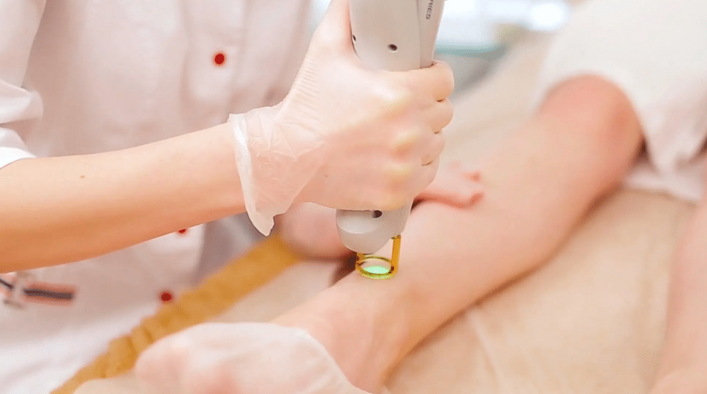 脫毛的時候身體各個部位都用一種方法嗎?