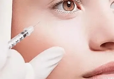玻尿酸填充臥蠶效果好嗎？有什么優(yōu)勢(shì)？有無(wú)其他填充方法