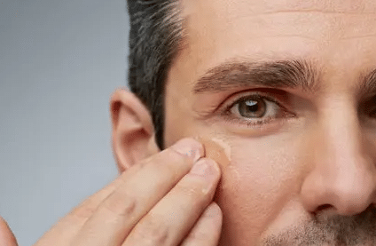 男士如何去除魚尾紋？|注射除皺針、玻尿酸去魚尾紋