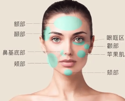 面部脂肪填充 面部脂肪填充