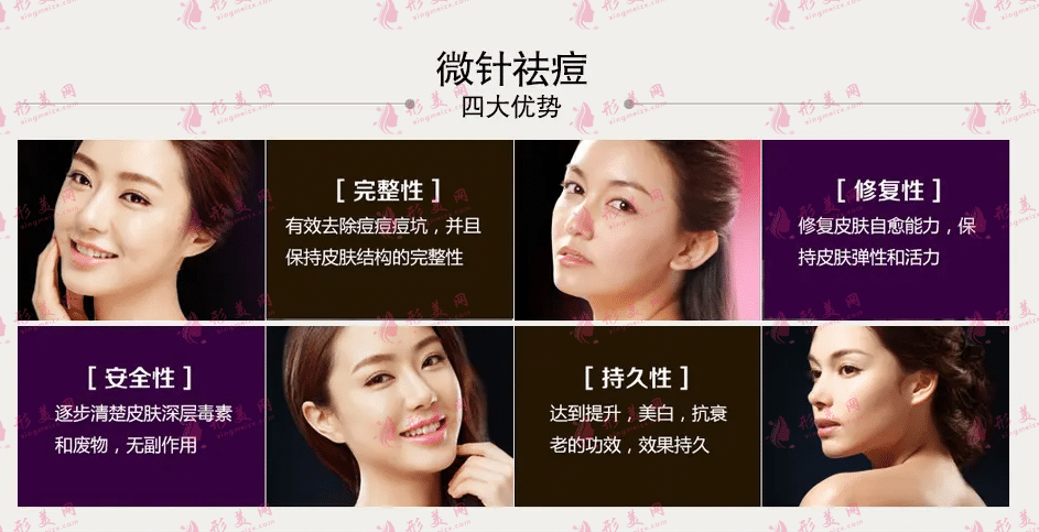 需要多長時間才能看到微針去除痘坑的效果?