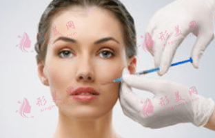 玻尿酸填充法令紋 玻尿酸填充法令紋