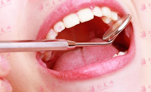 口腔治療 口腔治療