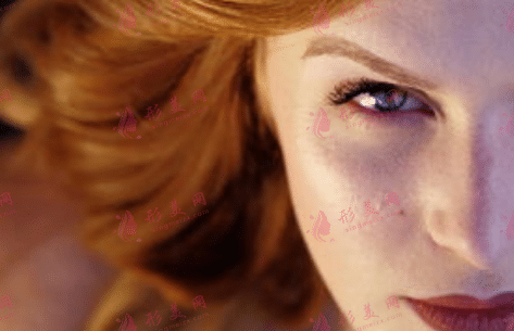 電波拉皮是射頻嗎？術(shù)后怎么護理？