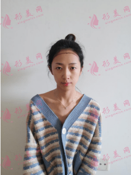 武漢新生郭建軍種植發(fā)際線怎么樣？好不好？案例分享