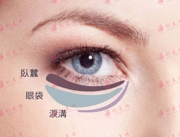 溶脂去眼袋手術(shù)多少錢?激光溶脂去眼袋果好嗎? 溶脂去眼袋手術(shù)多少錢?激光溶脂去眼袋果好嗎?