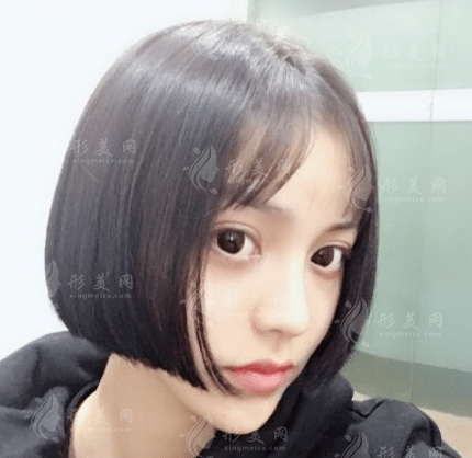 長春韓尚植發(fā)醫(yī)院怎么樣？2022發(fā)際線種植案例展示