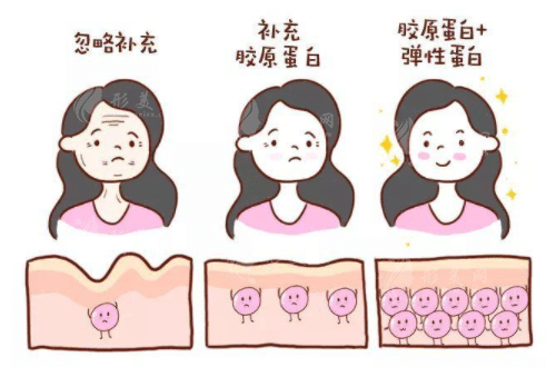 膠原蛋白怎么補？外涂、注射、口服？哪種方式最有用？