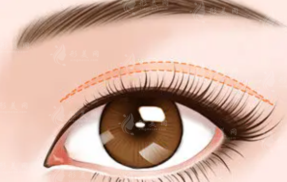 全國做雙眼皮哪家好？反饋說還是上海九院、北京協(xié)和、八大處好？