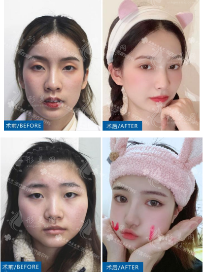 案例展示 案例展示