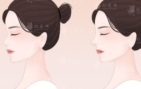 復(fù)旦大學(xué)附屬華山醫(yī)院隆鼻技術(shù)如何？醫(yī)生介紹+案例分享+價(jià)格表