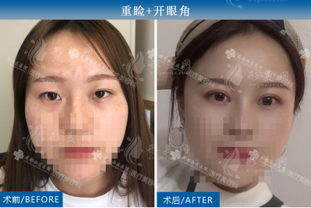 楊世界案例展示