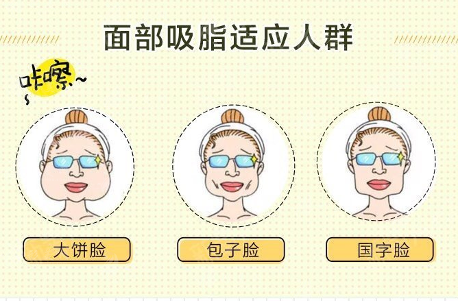 面部吸脂效果怎么樣？面部吸脂適用于所有人嗎？