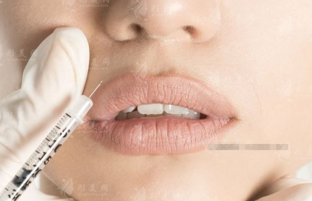 常見的唇部整形手術(shù)方法有哪些？唇部填充術(shù)、唇部提升術(shù)…