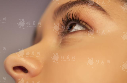 眼部提升手術(shù)多久恢復(fù)？介紹幾種快速恢復(fù)的方法